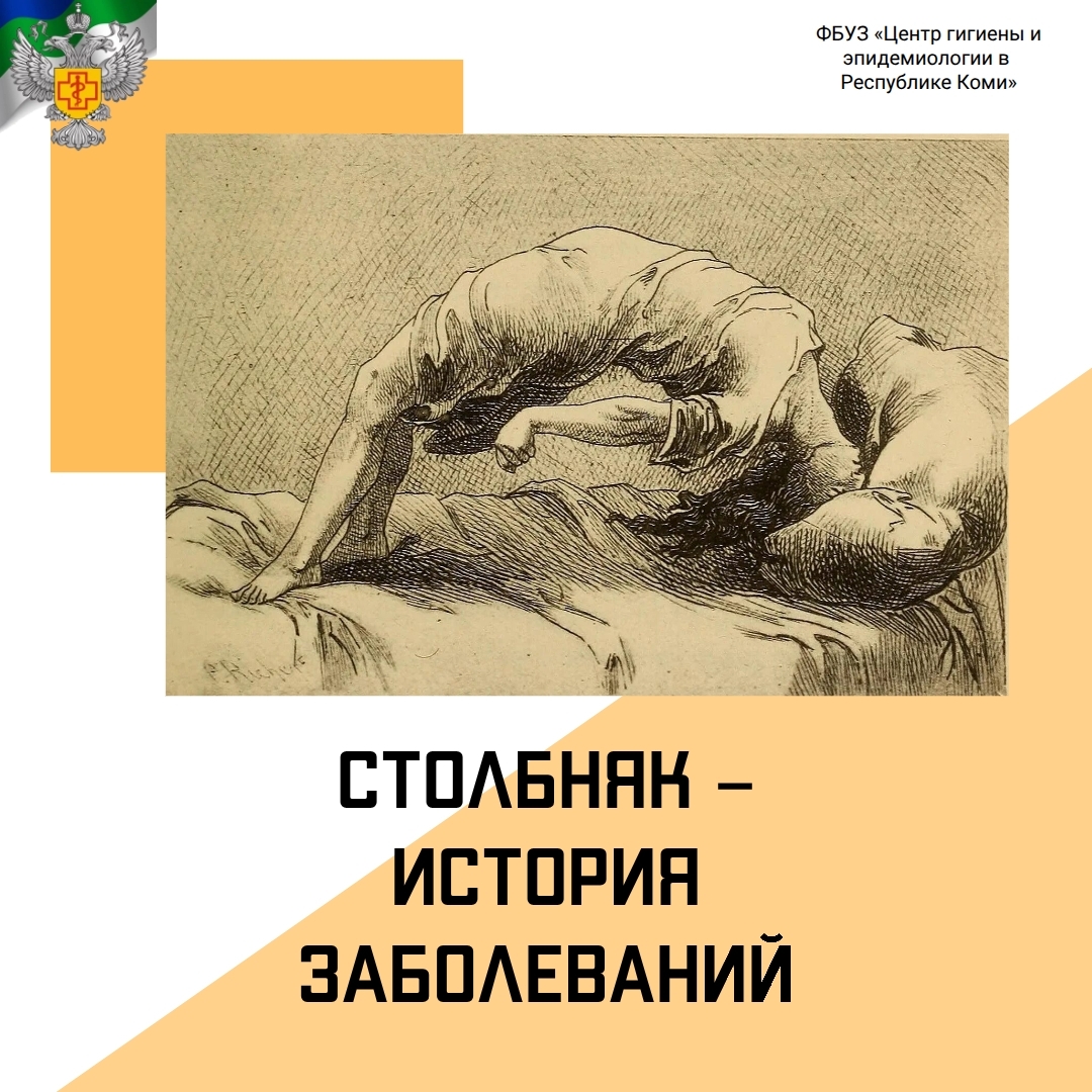 07.05 - Столбняк. История заболоевания